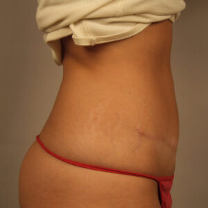 Case--27674 | After Body 2
