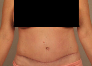 Case--29737 | After Dr. Bentley 1