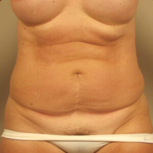 Case--39979 | Before Body 1