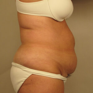 Case--41194 | Before Body 2