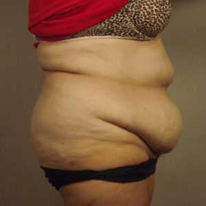 Case--42913 | Before Body 2