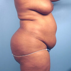 Case--46787 | Before Body 2