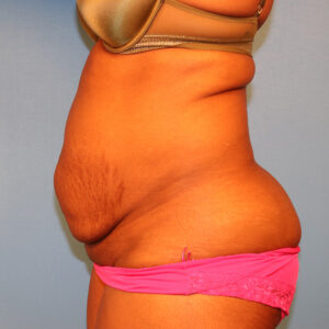 Case--58565 | Before Body 2