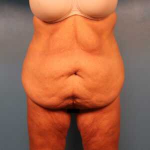Case--58971 | Before Dr. Budny 1