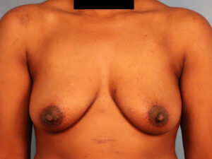 Case--60849 | Before Dr. Budny 1