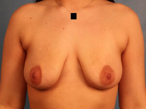 Case--61247 | Before Dr. Budny 1