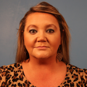 Frontal postoperative view of a patient after submental liposuction showing improved jawline definition and reduced fullness beneath the chin at a plastic surgery practice in Montgomery, Alabama.