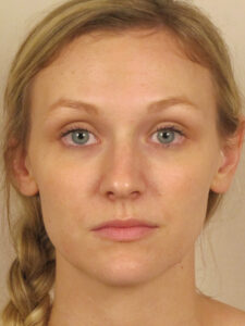Case--48417 | Before Dr. Bentley 1