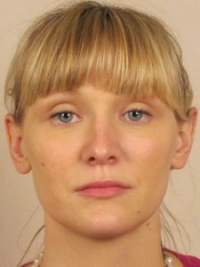 Case--48417 | After Face 1