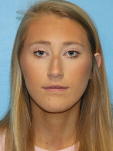Case--51601 | Before Dr. Bentley 1