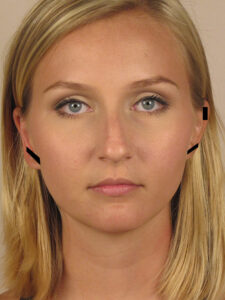 Case--51764 | Before Dr. Bentley 1