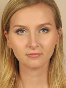 Case--51764 | After Face 1